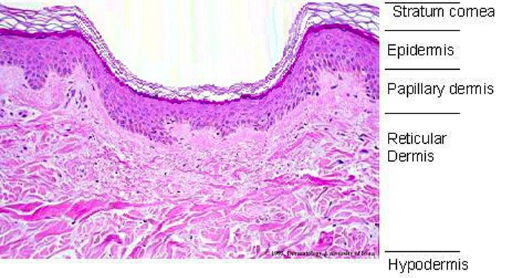 Box Scar skin histology under a microscope